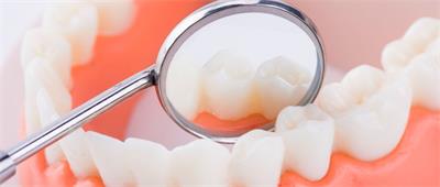 ��ǻ���I(y��)������ʲô������ 